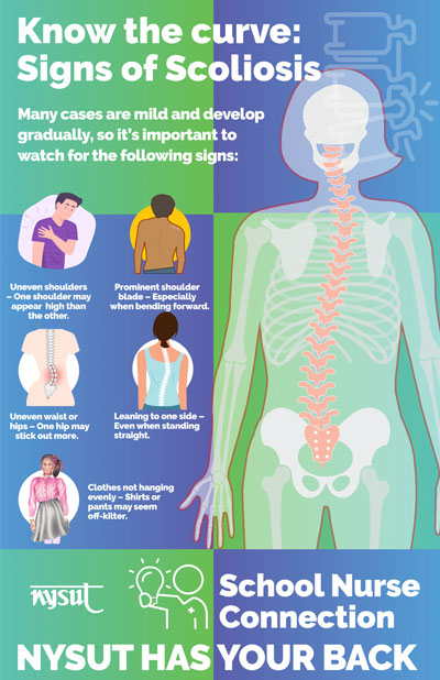 School Nurse Connection: scoliosis poster